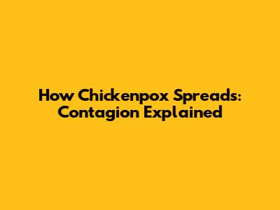 How Chickenpox Spreads: Contagion Explained